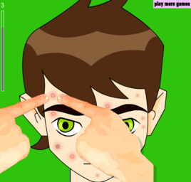 少年骇客挤痘痘