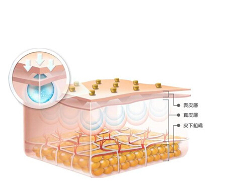 蛋白线做法令纹发炎的怎么办_360问答