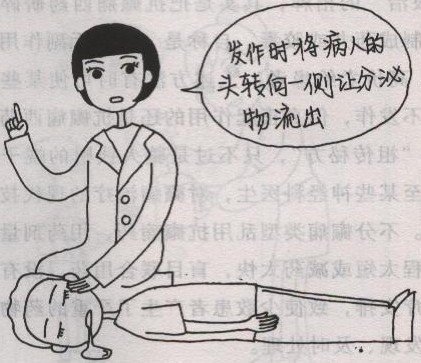 癫痫大发作也称全身性强直—阵挛发作,以意识丧失和全身抽搐为特征.